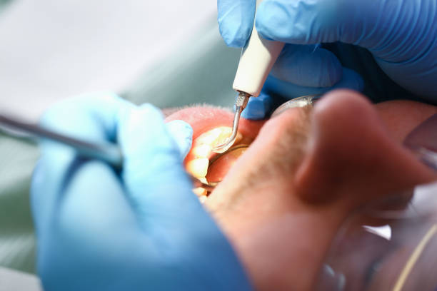 Best Pediatric Emergency Dentist in Nevada, TX