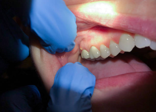 Best Emergency Dental Surgery in Nevada, TX