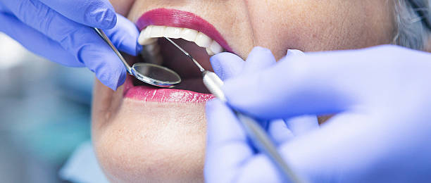 Best Emergency Broken Tooth Repair in Nevada, TX
